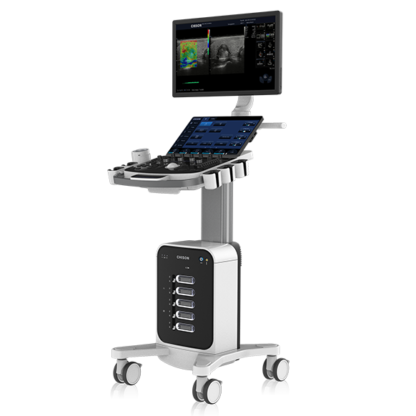 USG Doppler – CHISON SonoMax 9